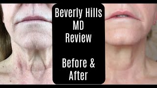 Beverly Hills MD Dermal Repair Complex—Lift and Firm Sculpting Cream—Before and After—AntiAging [upl. by Dovev808]