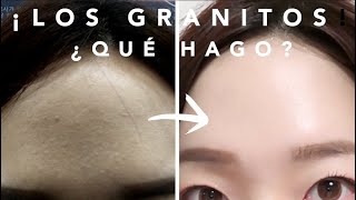 Los Granitos¿Qué hago [upl. by Ahsenrac]