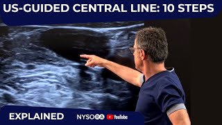 USGuided Central Line 10 Steps  Crash course with Dr Hadzic [upl. by Soigroeg]