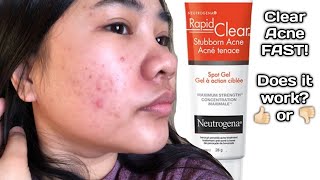 Neutrogena Rapid Clear Stubborn Acne Spot Gel Does it work [upl. by Lexerd]