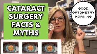 Complications of Cataract Surgery [upl. by Tedric]