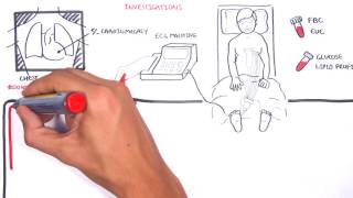 Acute Coronary Syndrome DETAILED Overview MI STEMI NSTEMI [upl. by Bolitho]