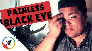 How To Give Yourself A Black Eye  No Pain [upl. by Ecyal]