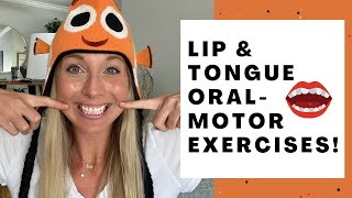 Bilateral vocal fold paralysis  Pre voice therapy [upl. by Worsham]