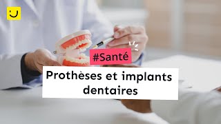 Prothèses et implants dentaires [upl. by Arda]