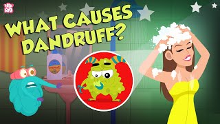 What Causes Dandruff  How To Treat Dandruff  The Dr Binocs Show  Peekaboo Kidz [upl. by Noiraa303]