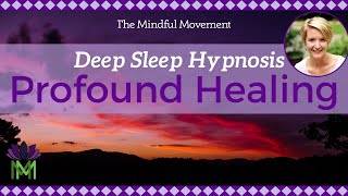 Use Your Powerful Mind Healing Deep Sleep Hypnosis  Mindful Movement [upl. by Loy774]