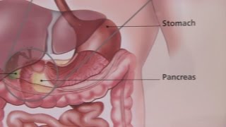 Irritable Bowel Syndrome Treatments  GI Society [upl. by Ecirehs]