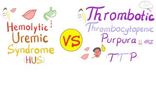 Thrombocytopenia  Signs and Symptoms and Approach to Causes [upl. by Ellerrehs]