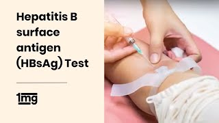 Hepatitis B surface antigen HBsAg Test  1mg [upl. by Rollin]