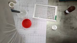 HBsAg ELISA test procedure [upl. by Benito]