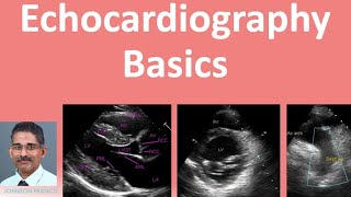 Echocardiography Basics [upl. by Stiegler107]