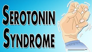 Managing Serotonin Syndrome [upl. by Jeraldine]