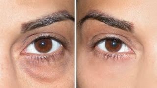 How to Cover Dark Circles  Under Eye Bags [upl. by Anihtyc]