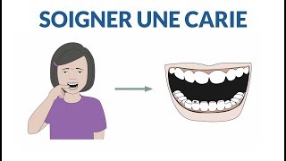 Comment soigner une dent cariée [upl. by Aihsia]