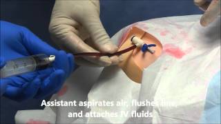 INTRAVENOUS IV CANNULATION in 5 mins How to insert [upl. by Peednama]