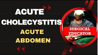 CHOLECYSTITIS Causes Signs and Symptoms Diagnosis and Treatment [upl. by Anaud]