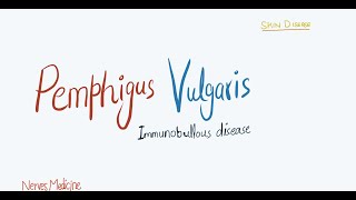 Pemphigus Vulgaris  clinical features pathophysiology and histology  immunobullous skin disease [upl. by Nivlag]