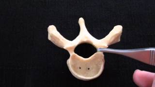 Typical Vertebra  Spinal column  Anatomy [upl. by Bound]