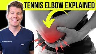 Doctor explains TENNIS ELBOW lateral epicondylitis  Symptoms causes amp treatment [upl. by Forsta]