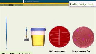 Urine Culture How To Interpret Count [upl. by Arrac310]