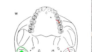 DYNAMIC OCCLUSION  Working vs Nonworking Movement amp Occlusal Grid [upl. by Alled]