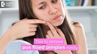 How to get rid of pus filled pimples  Dr Rasya Dixit [upl. by Waylin]