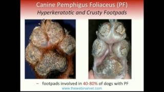 Pemphigus Foliaceus – Recent update on Pathogenesis Diagnostic and Treatment [upl. by Nanaek449]