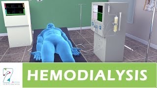 Hemodialysis [upl. by Ybhsa944]