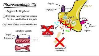 Aura Migraine  5 Facts You NEED to Know About Vision Loss from Visual Aura [upl. by Dyan792]