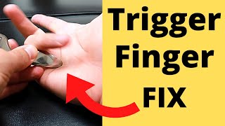 FIX Trigger Finger in 5 Minutes 3 Steps [upl. by Yatnuhs960]