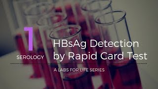 HBsAg Detection by Rapid Card Test [upl. by Theodor]