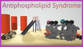 Antiphospholipid Syndrome Mnemonic for the USMLE [upl. by Fairleigh]