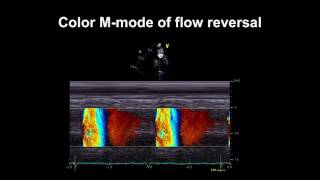 Standard views for a basic echocardiogram [upl. by Petrie]