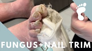 CRAZY THICK NAIL TRIM  FUNGUS [upl. by Assenav]