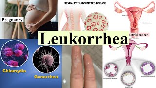 leukorrhea [upl. by Eceryt]