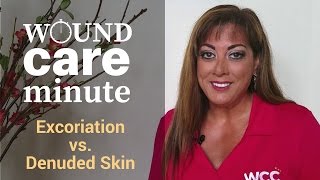 Whats the Difference Between Excoriation and Denuded Skin [upl. by Einna]