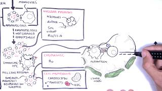 Systemic Lupus Erythematosus SLE  signs and symptoms pathophysiology investigations treatment [upl. by Wilson804]