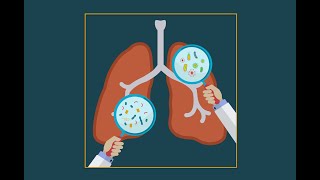 Pneumocystis jiroveci pneumonia pcp [upl. by Lauzon555]