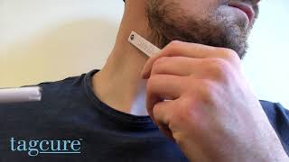 How to Remove Skin Tags Fast with Tagcure [upl. by Idroj780]