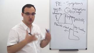 Pulmonary Embolism  Symptoms [upl. by Mccourt929]