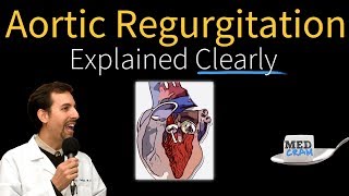 Aortic Regurgitation Insufficiency Explained Clearly [upl. by Larrej675]