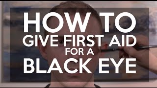 How to Treat a Black Eye  WebMD [upl. by Lloyd84]