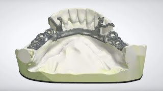 3Shape Dental System  RPD Design [upl. by Woermer]