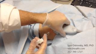 Hyaluronic Acid Injection to the Knee Joint 1 [upl. by Aciraj]