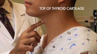 The Thyroid Exam Stanford Medicine 25 [upl. by Powe]