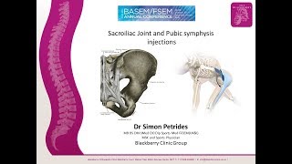 Sacroiliac Joint Injections and prolotherapy [upl. by Kristal]