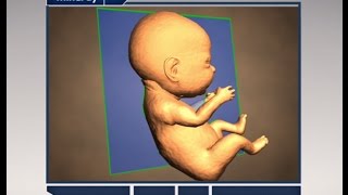 Step by Step to Get Perfect 3D4D Baby Image [upl. by Cyma]