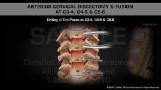 Cervical Vertebrae  C1C7  Bone Anatomy  Skeletal System  VLearning™ [upl. by Blainey]