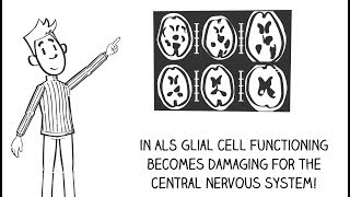 ALS and glial cells [upl. by Mcmillan]